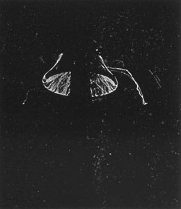 Type D protected by bottle-shaped shield.